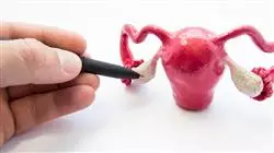 ##IMAGE##