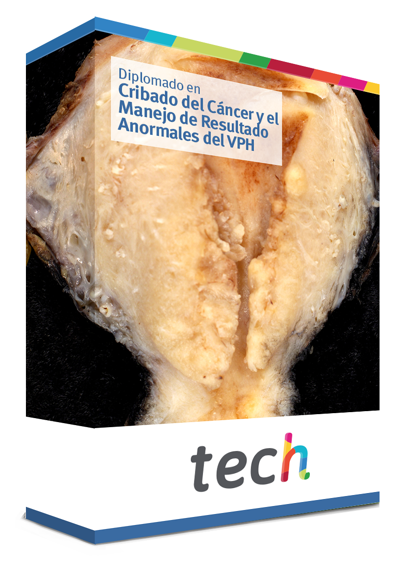 diplomado cribado cancer manejo resultado anormales vph caja
