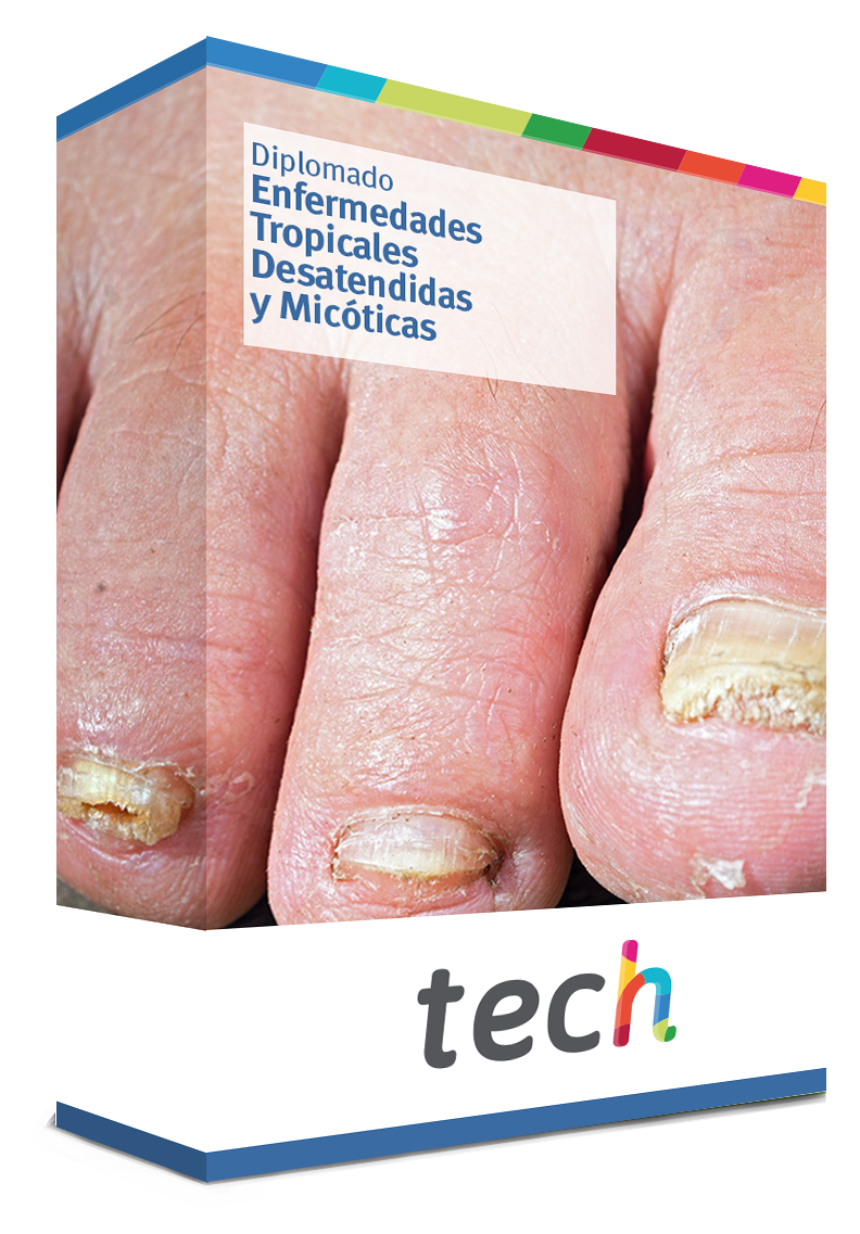 diplomado enfermedades tropicales micoticas caja