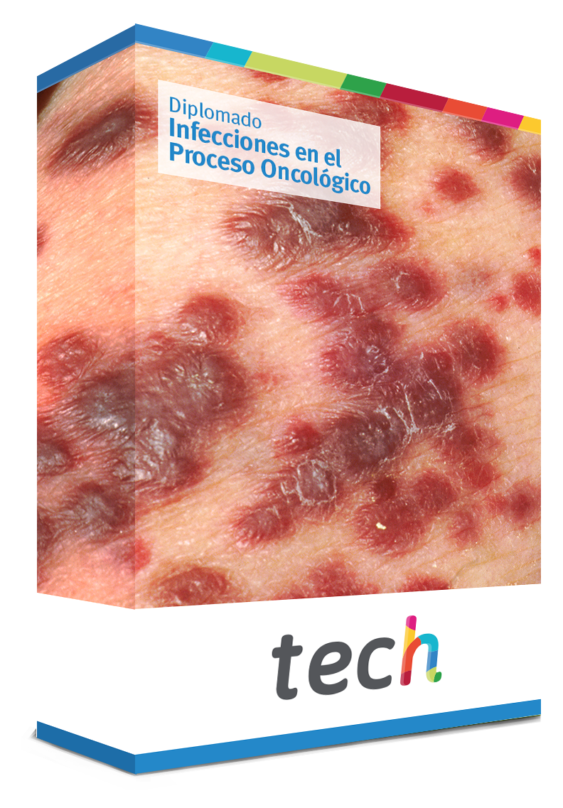 diplomado infecciones proceso oncologico caja