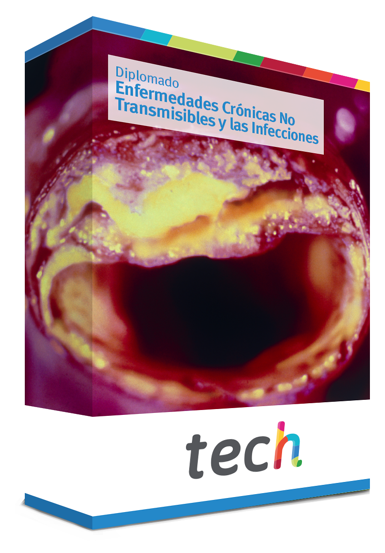 diplomado enfermedades cronicas no transmisibles infecciones caja