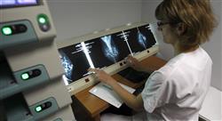 curso tratamiento radioterápico de tumores de mama