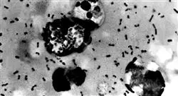 formacion enfermedades infecciosas raras