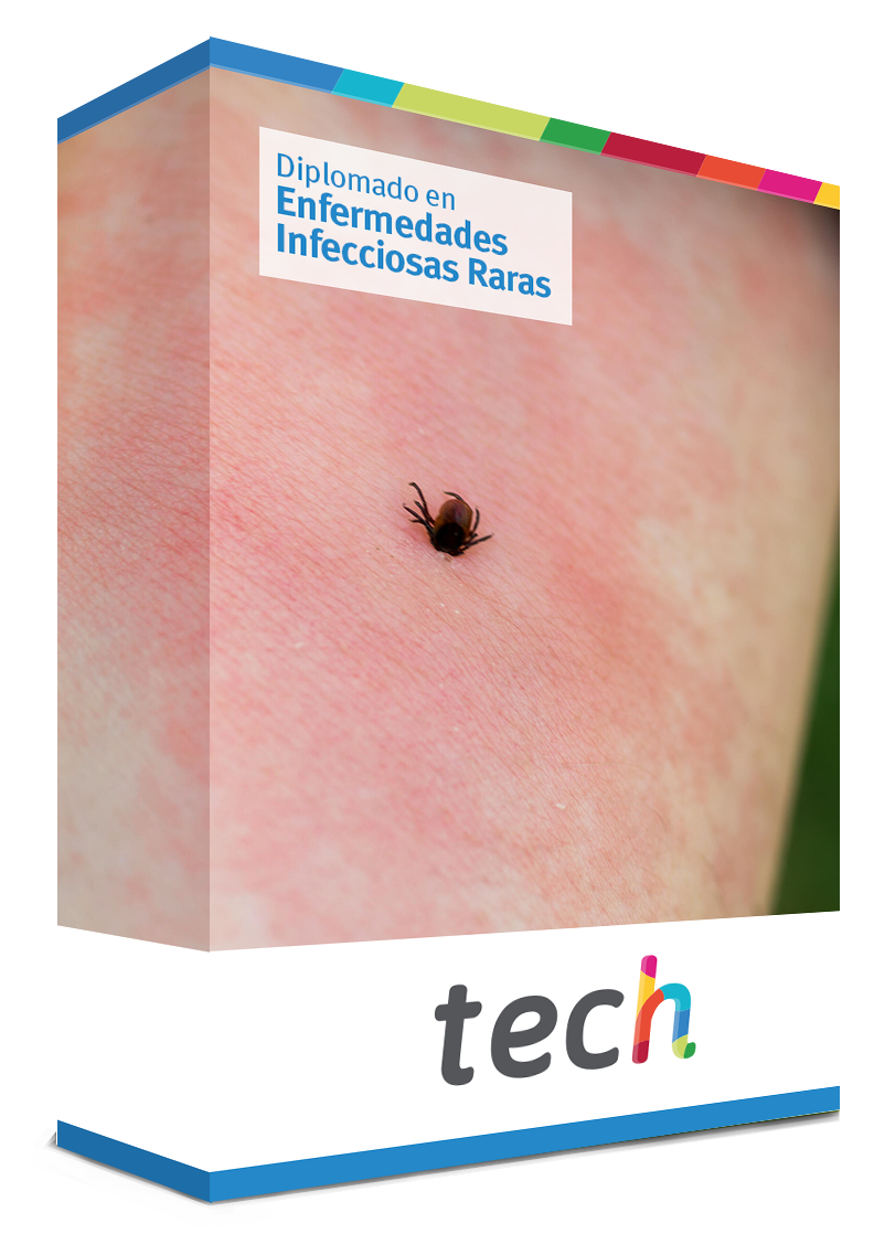 diplomado enfermedades infecciosas raras caja