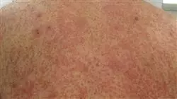##IMAGE##