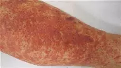 ##IMAGE##