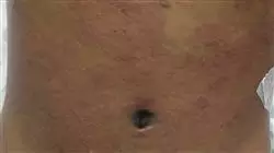 ##IMAGE##