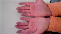##IMAGE##