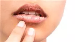 ##IMAGE##