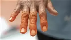 ##IMAGE##