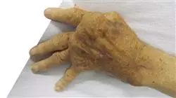 ##IMAGE##