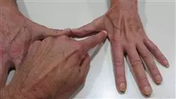 ##IMAGE##