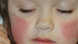cfc online dermatología pediátrica