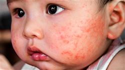 curso cfc dermatología pediátrica