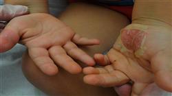 curso formacion continuada dermatología pediátrica