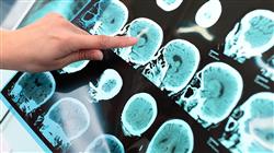 curso cfc neurología y psiquiatría pediátrica