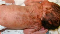 5 curso patologia sistemica infantil afectacion cutanea
