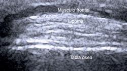 cfc técnicas de imagen para diagnóstico, tratamiento láser y cirugía dermatológica pediátrica