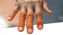 ##IMAGE##