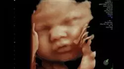 ##IMAGE##