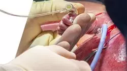 ##IMAGE##