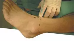 ##IMAGE##