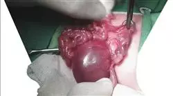 ##IMAGE##