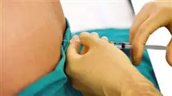##IMAGE##