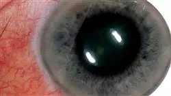 ##IMAGE##