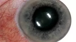 ##IMAGE##