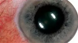 ##IMAGE##
