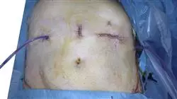 posgrado diagnostico oncologia digestiva