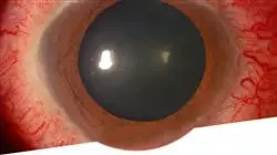 ##IMAGE##