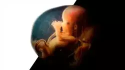 ##IMAGE##