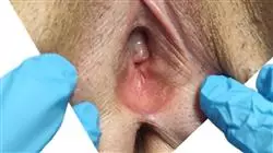 ##IMAGE##