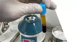 ##IMAGE##