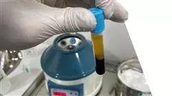 ##IMAGE##