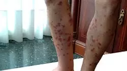 ##IMAGE##