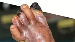 ##IMAGE##
