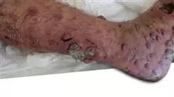 ##IMAGE##