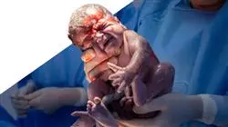 ##IMAGE##