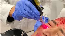 ##IMAGE##