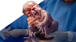 ##IMAGE##