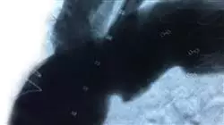 ##IMAGE##