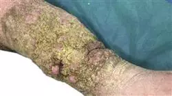 ##IMAGE##