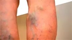 ##IMAGE##