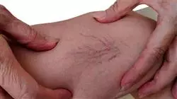 ##IMAGE##