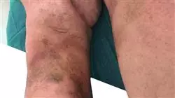 ##IMAGE##