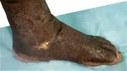 ##IMAGE##