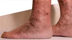 ##IMAGE##
